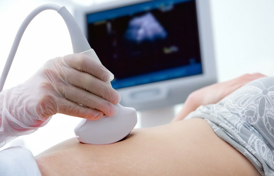 7_Week_ultrasound